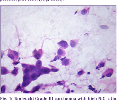 Figure From Correlation Of Various Cytological Grading Systems With