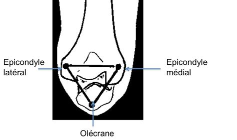 Repères anatomiques osseux du coude Le livre de sémiologie médicale