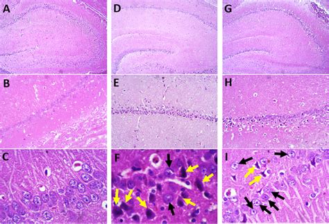 Hematoxylin And Eosin H And E Staining Of Ca1 Hippocampal Neurons For