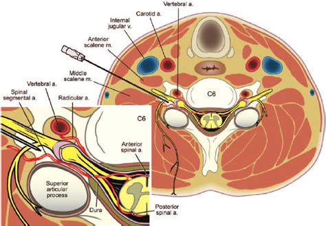 Cervical Nerve Root Anatomy