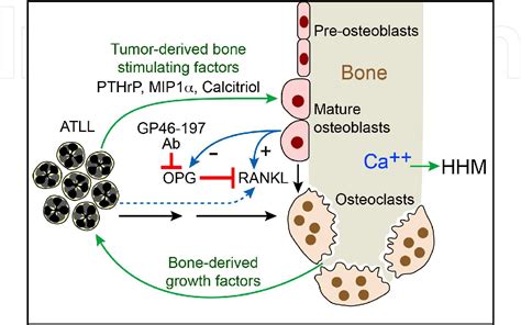 [PDF] Mechanisms of Humoral Hypercalcemia of Malignancy in Leukemia/Lymphoma | Semantic Scholar