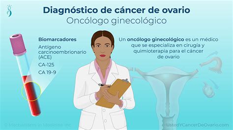 Presentación De Diapositivas Diagnóstico Del Cáncer De Ovario