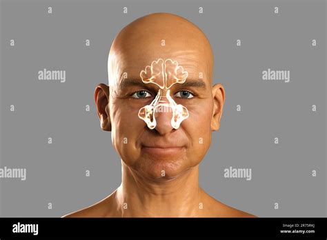 Human Sinuses Computer Illustration The Sinuses Are Membrane Lined
