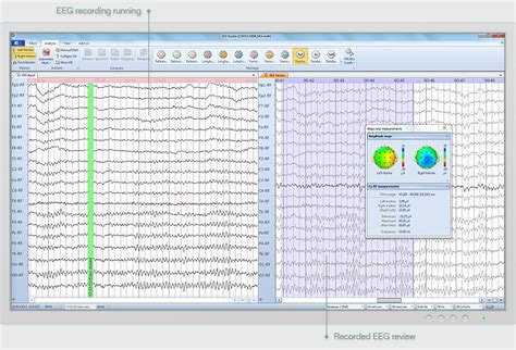 Pracownia EEG Psycholog Psychoterapia Legionowo Płońsk Biofeedback