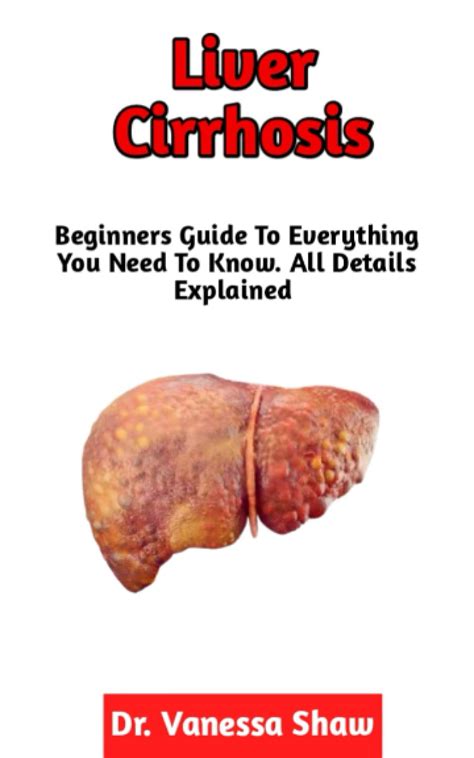 Buy Liver Cirrhosis A Perfect Guide On Diagnosis Causes Symptoms