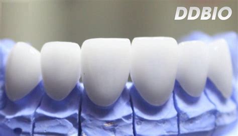 Bảo hành răng passiondentallab