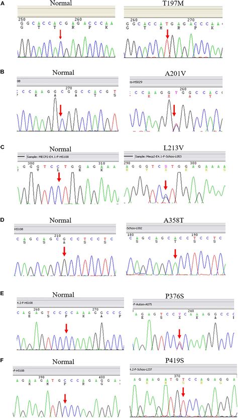 Frontiers Detection Of Rare Methyl CpG Binding Protein 2 Gene