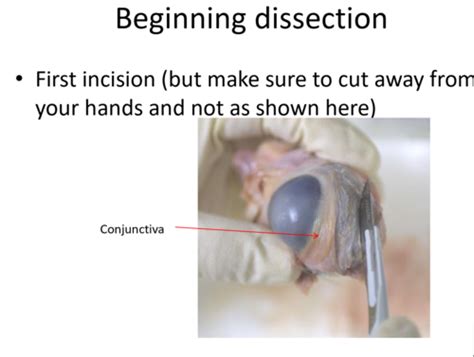 eye - dissection Flashcards | Quizlet