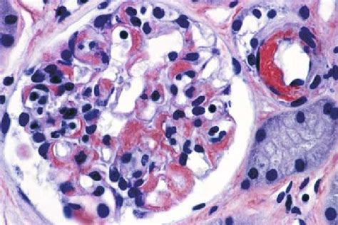 2 Congo Red Stain Disclosing The Abnormal Material To Stain Download Scientific Diagram