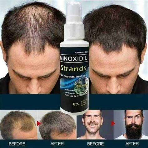 Minoxidil Strands Hair Spray Regrowth Treatment 6 Original Topical