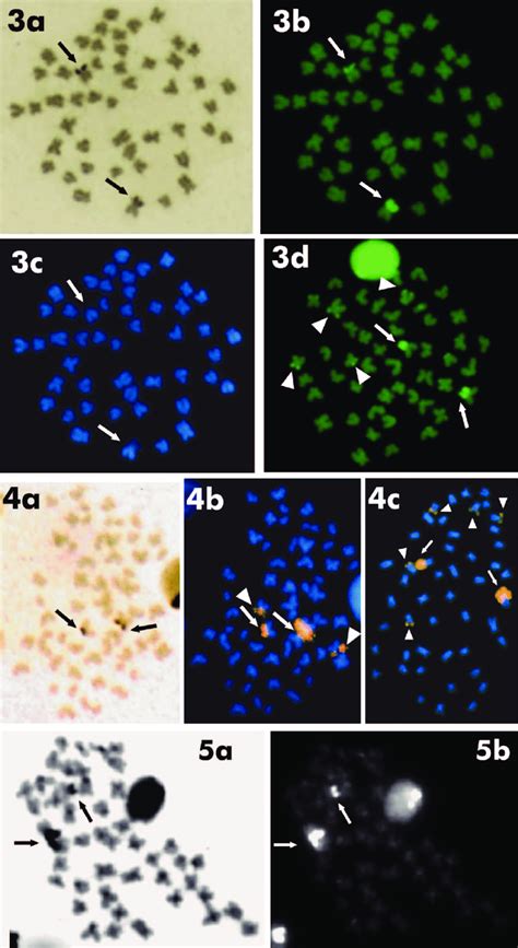 Metaphase Plate Sequentially Stained With A Silver Nitrate B