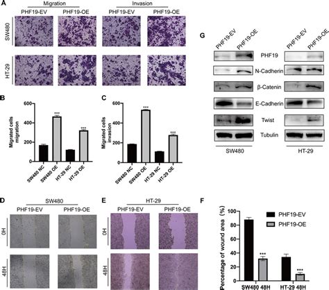 Overexpression Of PHF19 Promoted CRC Cell Migration And Invasion By