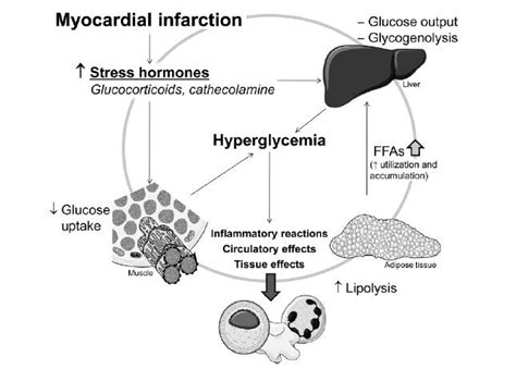 Cardiovascular Effects Of Hyperglycemia During The Acute Phase Of