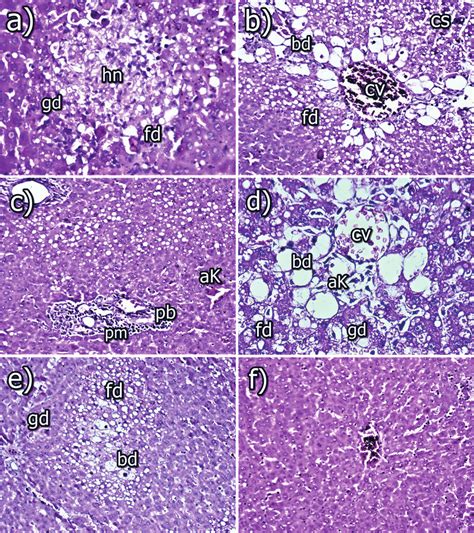 Histopathological Photomicrographs Showing The Ccl 4 Induced