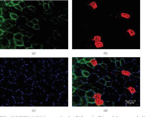 Figure 3 From Use Of Bodipy 493503 To Visualize Intramuscular Lipid