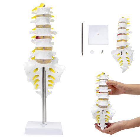 Buy Skumod Lumbar Spine Anatomy Model Human Lumbosacral Segment Model