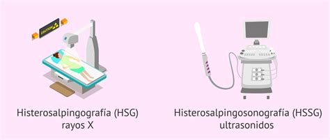 Qué es la histerosalpingografía Indicaciones y resultados