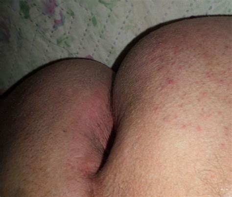My Ass Ready For A Cock Nude Pics Xhamster