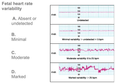 External Fetal Monitoring Flashcards Quizlet