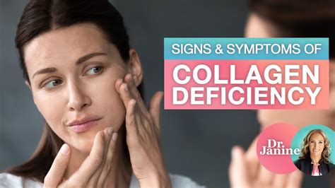 Collagen Signs And Symptoms Of Collagen Deficiency Dr J9 Live Youtube