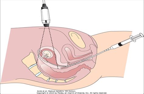 E L Screening Diagnostic Testing Assessment Of Fetal Well Being