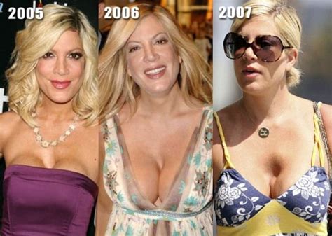 Tori Spelling Plastic Surgery Before After Cumception