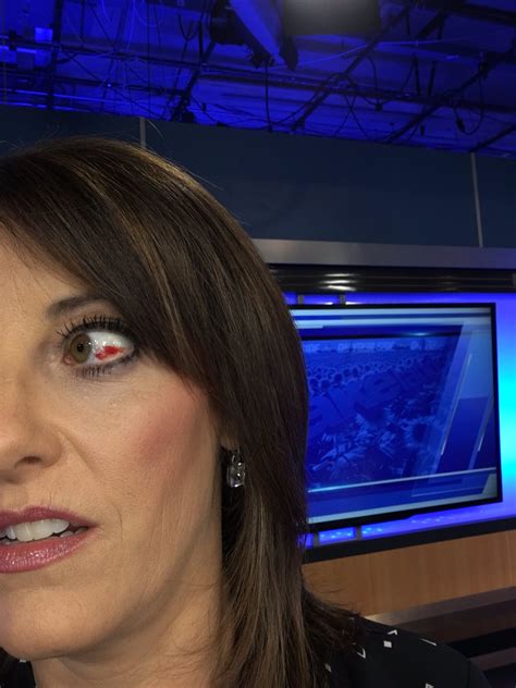 Breaking: Kake News Anchor Attacked—What You Need To Know