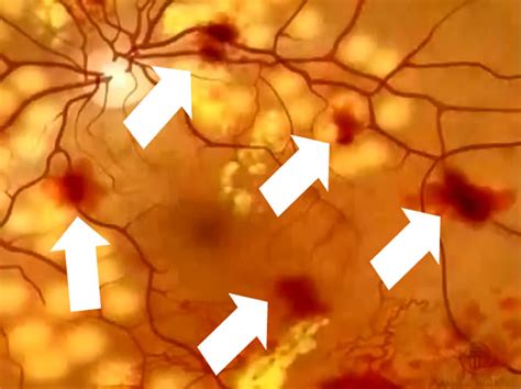 Banner Retinopatia Retina Do Bem 2020
