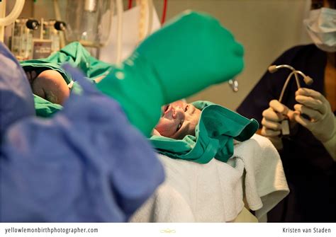 C-section birth and meet-the-family sessions | Teja — Yellow Lemon ...
