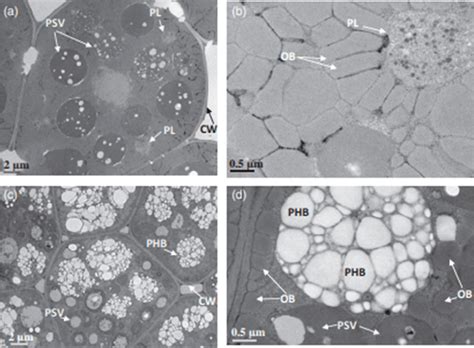 Transmission Electron Micrographs Of Mature Seeds Of Wild Type And PHB