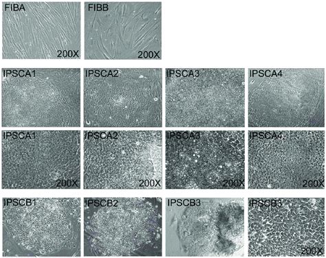 Phase Contrast Images Of Fib And Ipsc Lines Used In This Report As