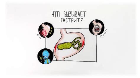(2016) ФОСФАЛЮГЕЛЬ и Де Нол® чтобы гастрит быстрее прошел! - YouTube