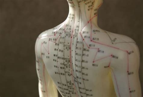 acupuncture nz   acupuncture