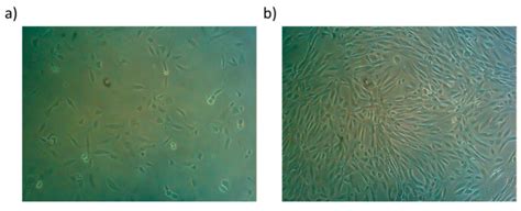 Cell Morphology Of Early Adherent Urine Derived Stem Cells USCs 15