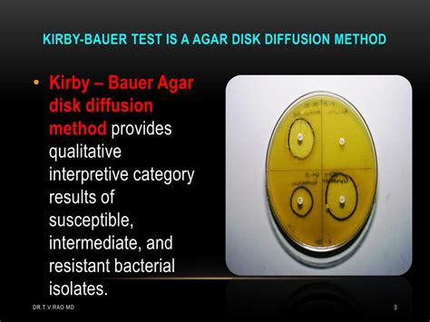 PPT Kirby Bauer Disk Diffusion Testing Skill Based Learning