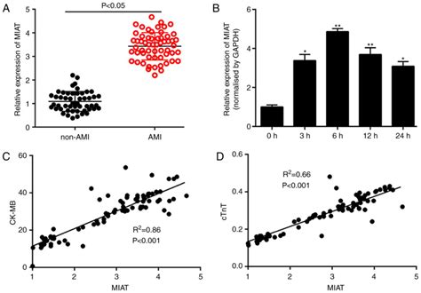 Long Noncoding Rna Miat A Potential Role In The Diagnosis And