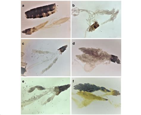 Egg Melanization Dissected Female Aedes Albopictus Skuse