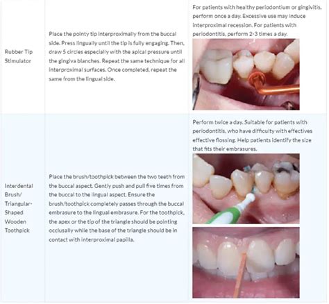 Dentalcare Ce680 Peri Implantitis Course User Guide