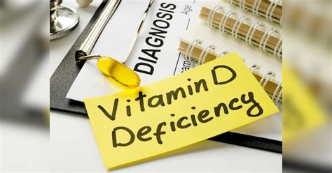 Symptoms Of Vitamin D Deficiency In Women How To Cure Vitamin D Deficiency Naturally Vitamin D