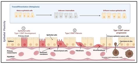 Emt Categorization Based On Epithelial Plasticity Emt Is Categorized Download Scientific