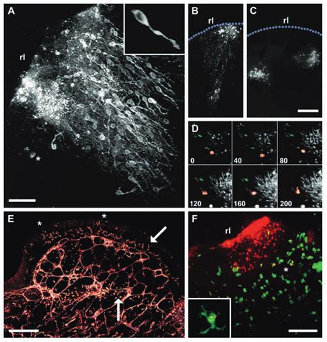 Migrating Cells Labelled Hours After Dii Application To Rhombic Lip