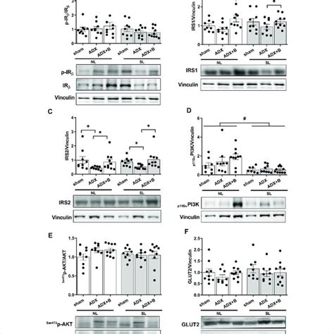 Liver Expression Of Insulin Receptor Ir A Insulin Receptor