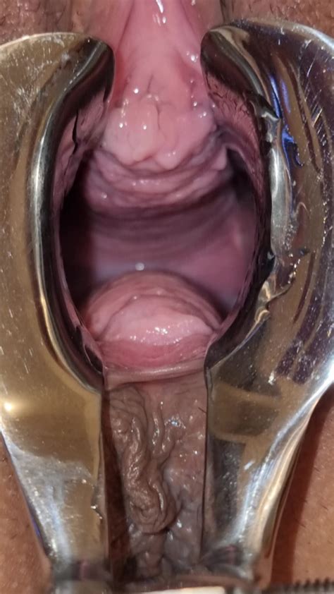 Spekulum Nasse Vagina Doctor MILF Porn Feat Electro XHamster