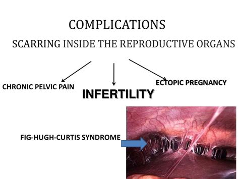 Pelvic Inflammatory Disease