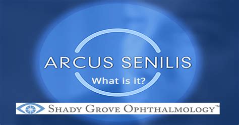 Arcus Senilis - Shady Grove Ophthalmology: Anthony Roberts MD