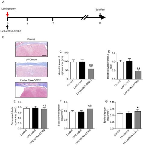 LncRNA COX2 Decreases Laminectomy Induced Epidural Scar Formation A