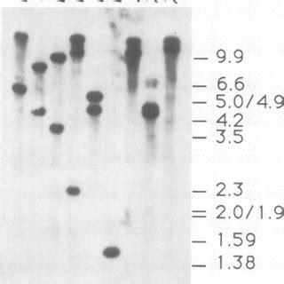 Southern Hybridization Of Yeast Genomic Dna Restriction Digests With A