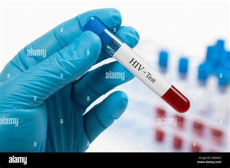 Hiv Test Hi Res Stock Photography And Images Alamy