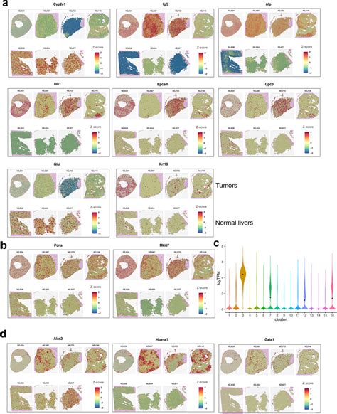 Spatial Transcriptomic Analysis Of Abc Myc Tumors Validates The