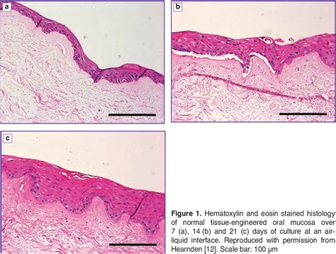 Figure From Imaging Of D Tissue Engineered Models Of Oral Cancer